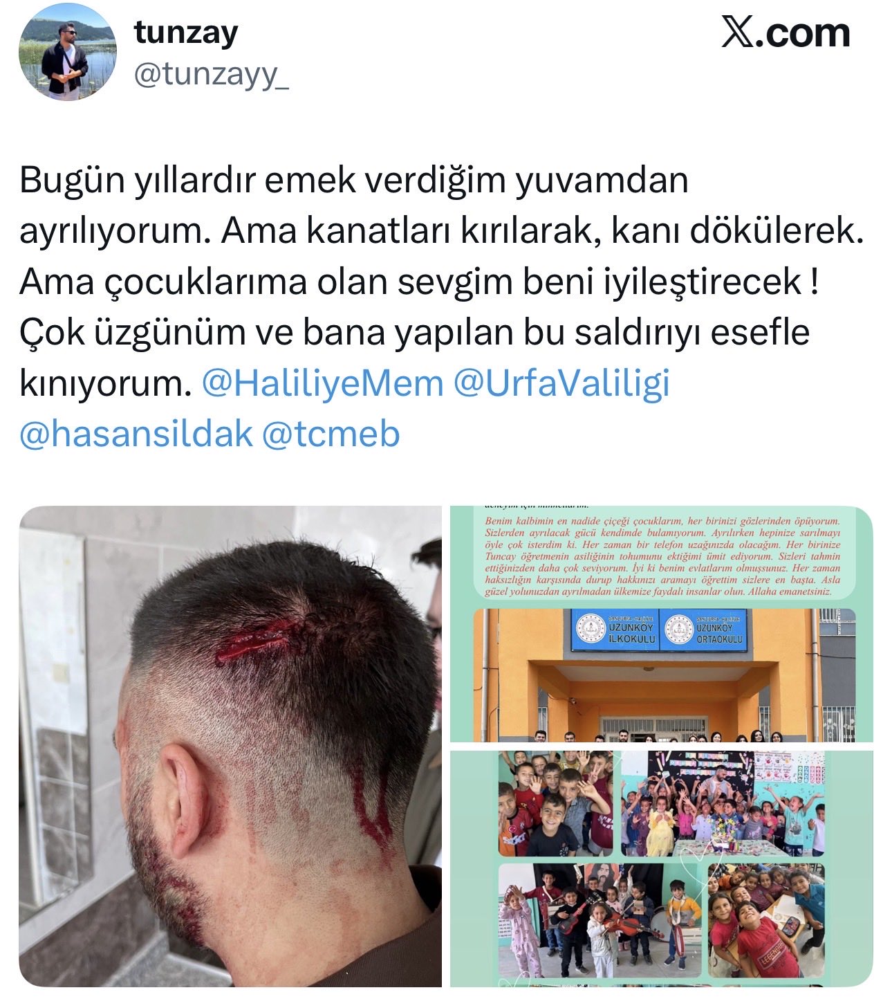 VELİ ŞİDDETİ MAĞDURU ÖĞRETMEN OKULDAN AYRILDI!