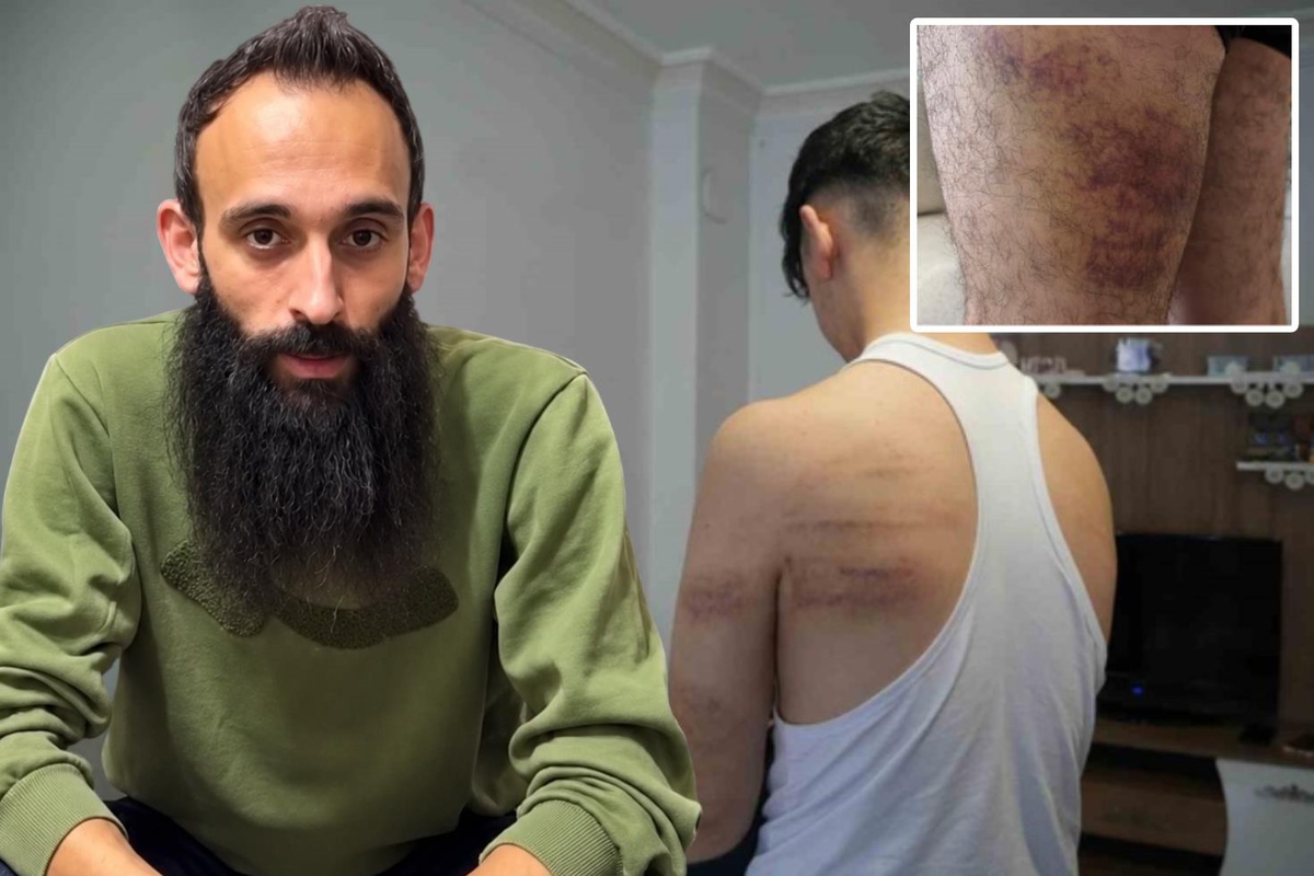 15 YAŞINDAKİ ÇIRAĞA İŞKENCEDE YENİ GELİŞME! BERBER TUTUKLANDI