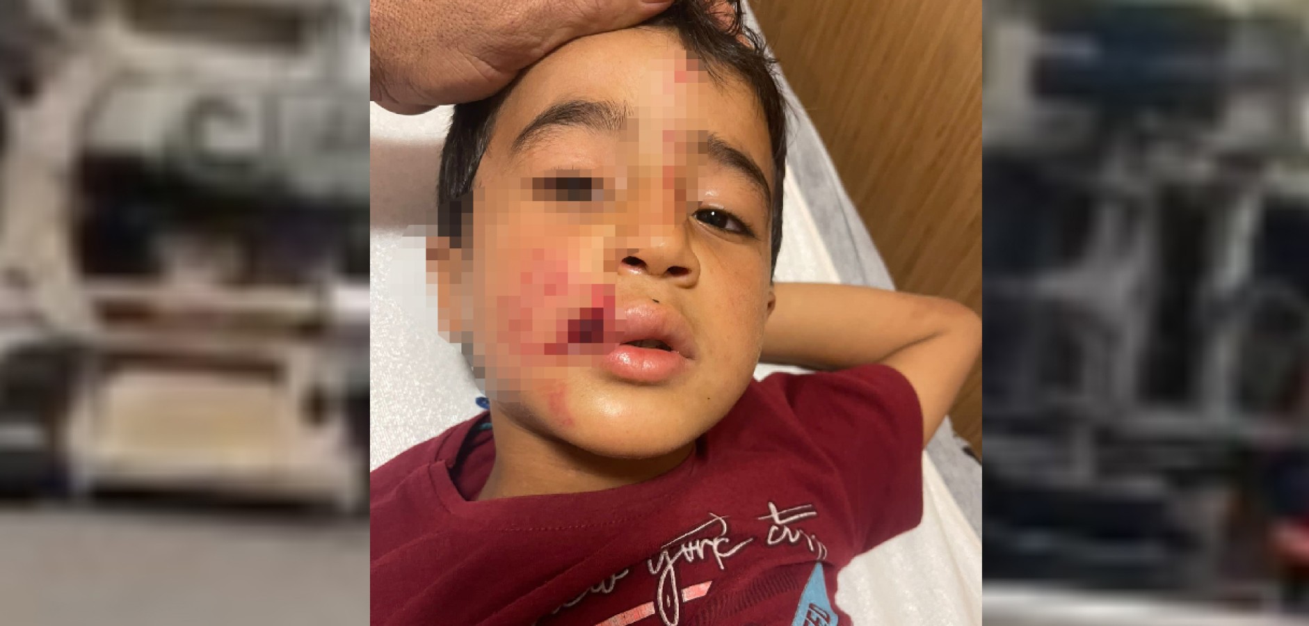 Şanlıurfa'daki çocuğu sokak köpeği ısırdı!;